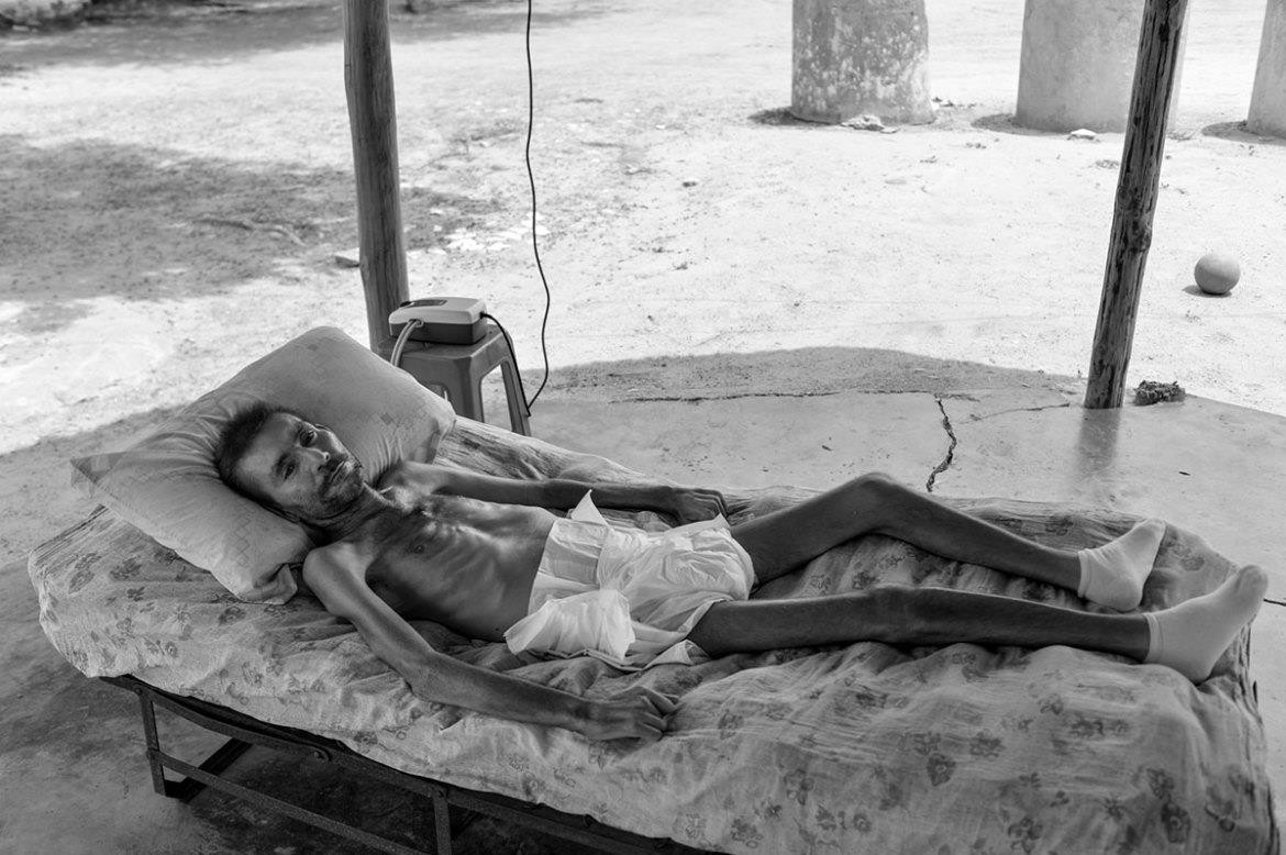 How Hunger Kills - Effects of Chronic Hunger